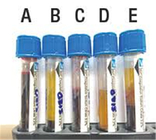 Tubo azul coagulado do sangue do Cbc  da parte superior, tubos de ensaio da coleção da amostra de sangue fornecedor